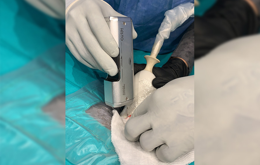 Realización de citología y biopsia para diagnóstico oncológico en mascotas Veterinario realizando una citología y biopsia a una mascota en clínica oncológica veterinaria