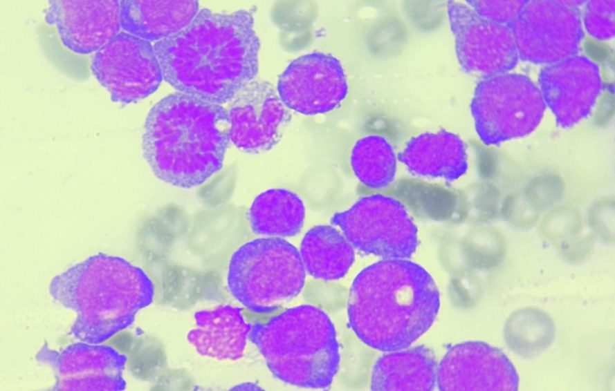 Oncohematología veterinaria: Tratamiento especializado para cáncer hematológico en mascotas Oncohematología veterinaria: Diagnóstico y tratamiento de leucemia y linfoma en mascotas