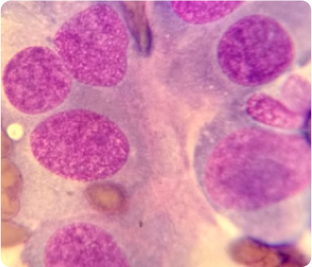 Imagen de análisis de laboratorio para detectar neoplasias de vejiga en perro o gato