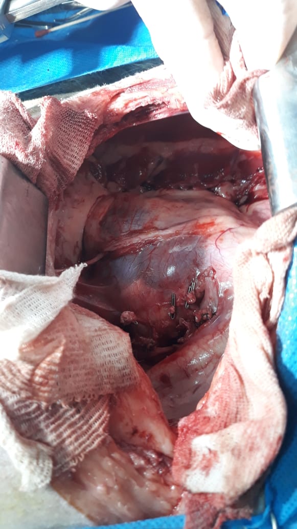 Resolución de un síndrome de osteopatía hipertrófica asociado a carcinoma pulmonar en un canino.